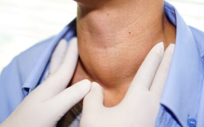 Single Radiofrequency Ablation Has Long-Term Effects on Benign Thyroid Nodules